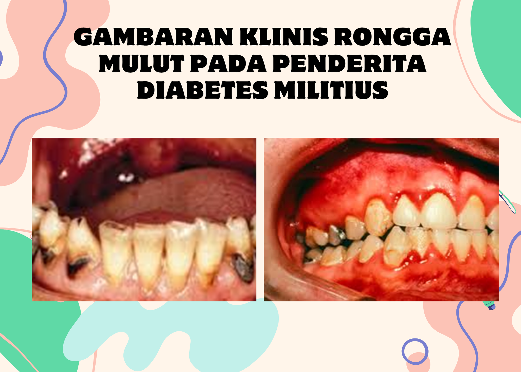 Slide 29