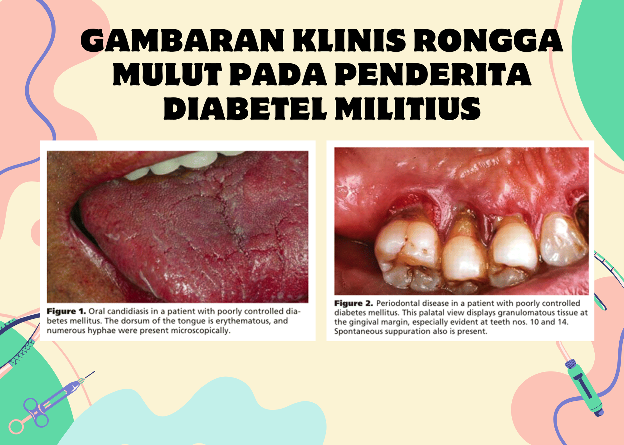 Slide 68